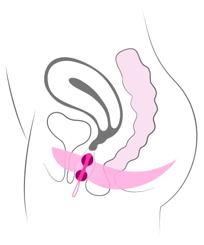 Platzierung von Lustkugeln in der Vagina