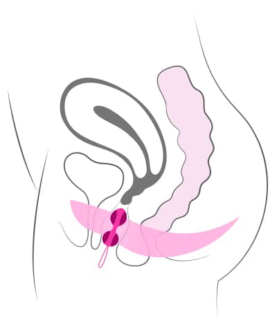 Placement of pleasure balls in the vagina